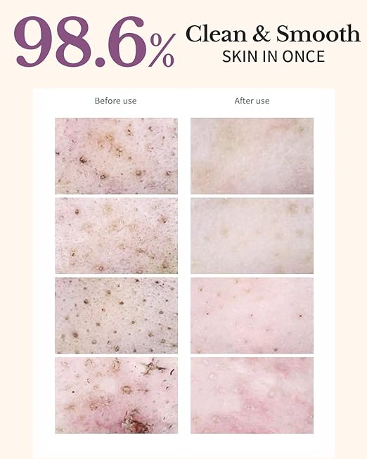 Ongredients Pore Cleansing Pads