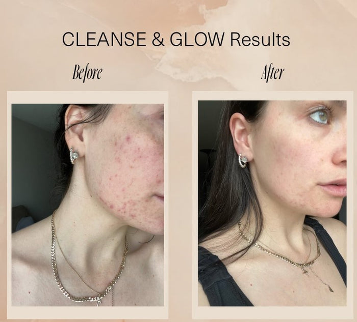 CLEANSE & GLOW MINI Set