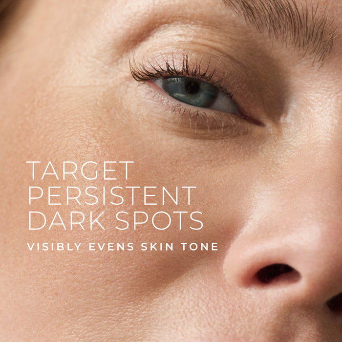 Close-up of a person's eye with text overlay about treating persistent dark spots to visibly even skin tone