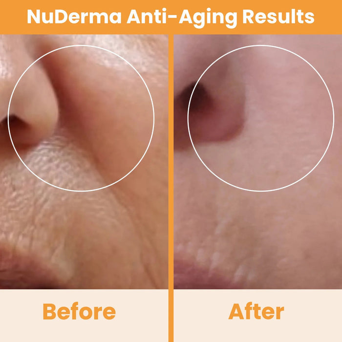 NuDerma Anti-aging before and after results