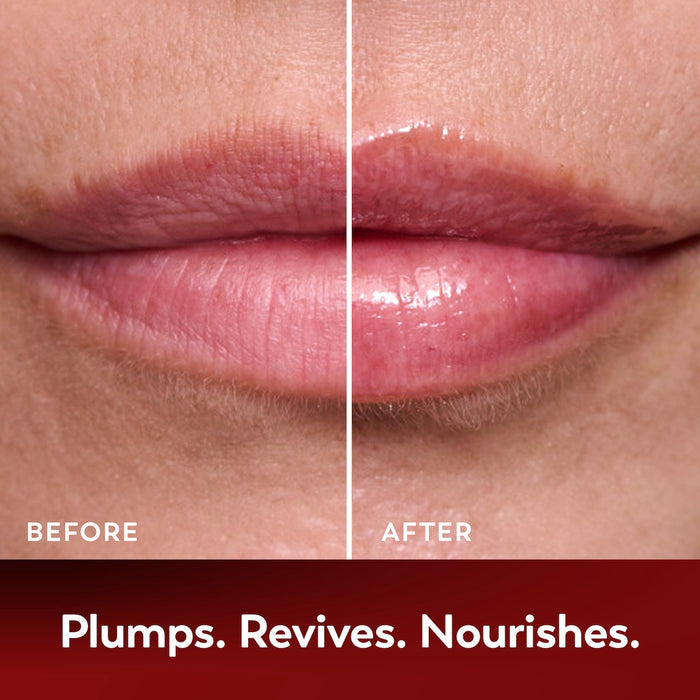 Side by side image showing before and after applying Regenerist Lip Plumping Treatment. Plumps, revives, nourishes