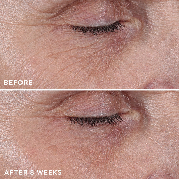 Model posing with before and after using Regenerist Eye Wrinkle Correcting Treatment on eyes for 8 weeks