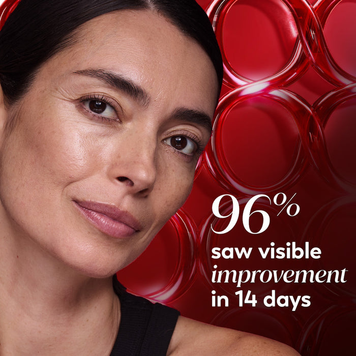 Model posing. 96% saw visible improvement in 14 days.
