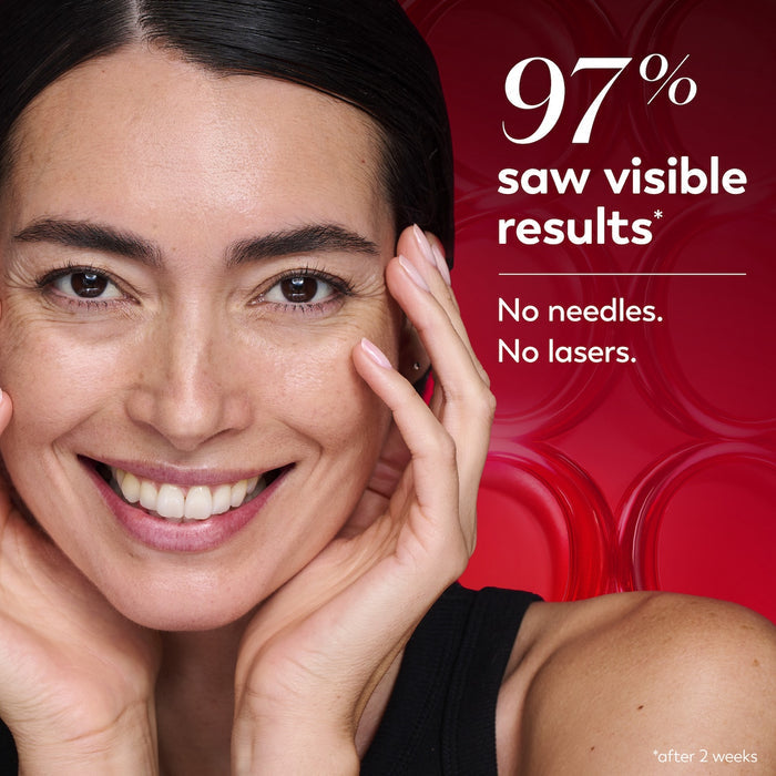 Model posing and smiling with hands on face. 97% saw visible results*. No needles, no lasers. *after 2 weeks.