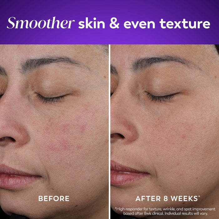 Model showing before and after using Retinol Face Moisturizer. Smoother skin and even skin texture