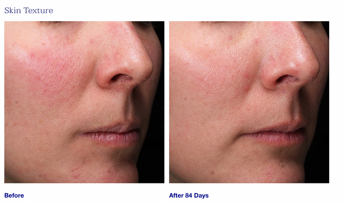 Retinol+ Emulsion 0.3