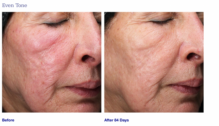 Retinol+ Emulsion 0.3