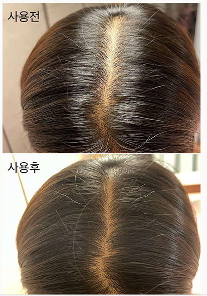 Silkeed Scalp Pencil Hair Ampoule