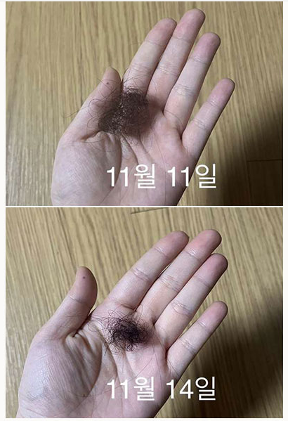 Silkeed Scalp Pencil Hair Ampoule