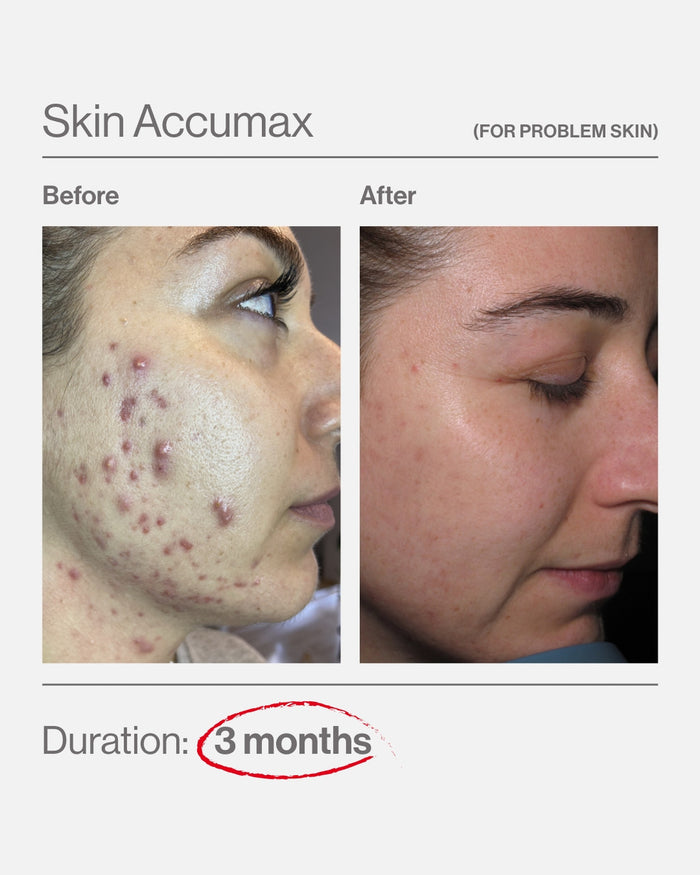 Skin Accumax® 180 Capsules