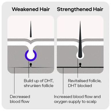 Sons DHT Blocking Hair Growth Shampoo 200ml x4