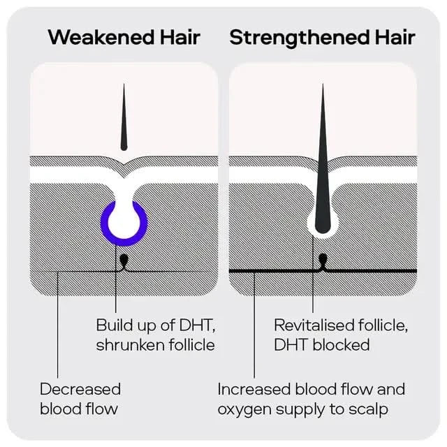 Sons Minoxidil 5% Spray 3 Pack x2