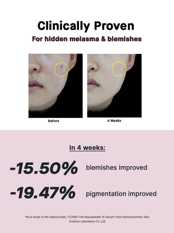 Before and after photos from COSRX The Niacinamide 15 Serum clinical trial showing 15.5% blemish reduction and 19.47% pigmentation improvement after 4 weeks; niacinamide-based Korean serum targeting hyperpigmentation and acne marks.
