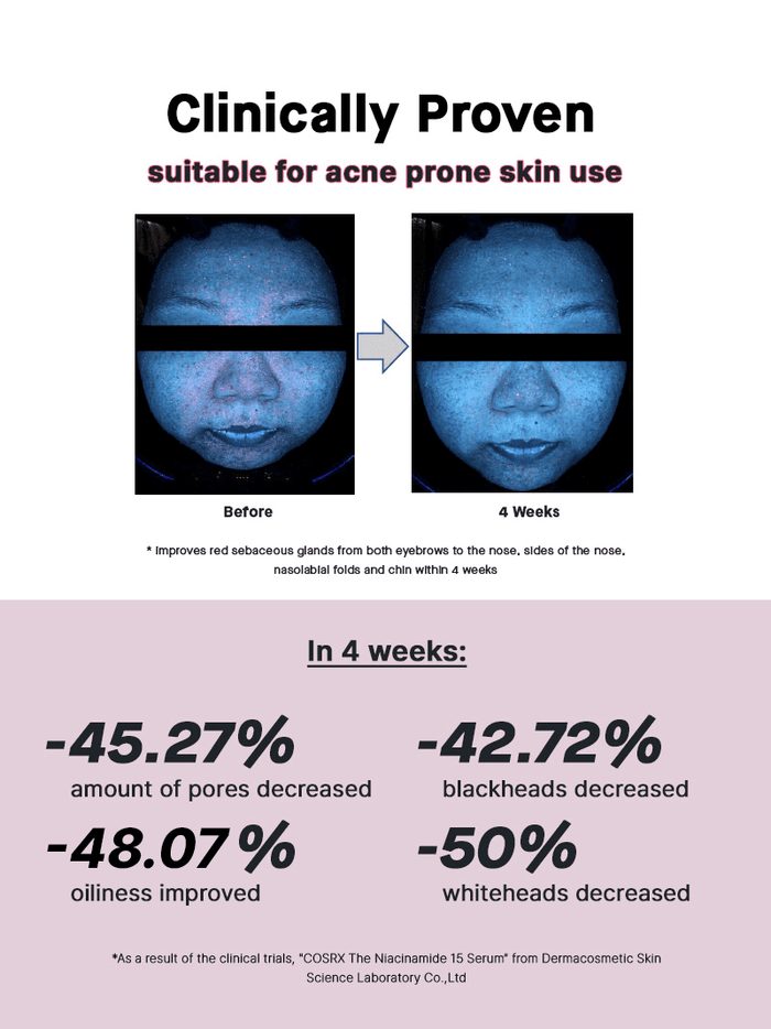 Dermacosmetic laboratory test results of COSRX The Niacinamide 15 Serum proving 45.27% decrease in pore count, 48.07% less oiliness, and up to 50% reduction in whiteheads within 4 weeks; suitable for acne-prone, oily skin types.