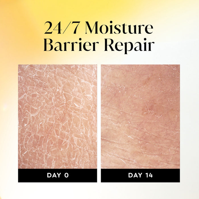 Before and after images from day 0 to day 14 using Ultra Moisture Body Wash Shea Butter. 24/7 moisture barrier repair